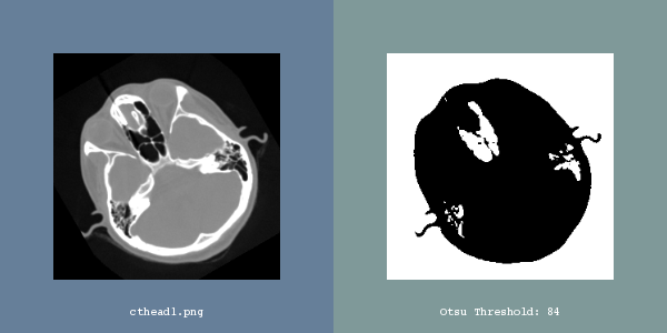 ITK Examples Baseline Segmentation TestOtsuThresholdImageFilter.png