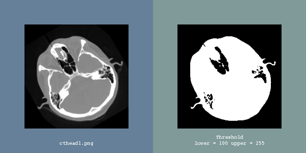 File:ITK Examples Baseline ImageProcessing TestBinaryThresholdImageFilter.png