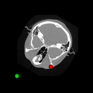 ITK Examples Baseline ImageProcessing TestMinimumMaximumImageCalculator.png