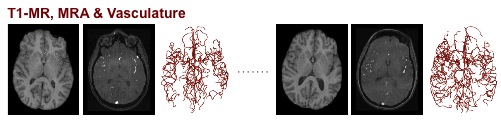 Intracranial-Teaser.jpg