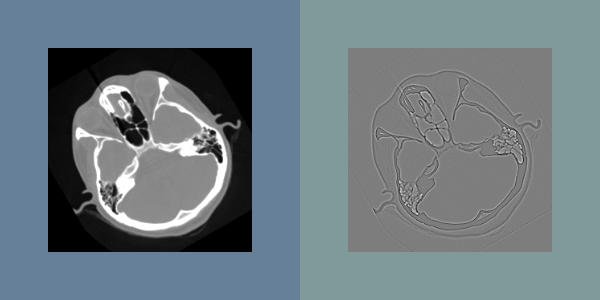 File:ITK Examples Baseline ImageProcessing TestLaplacianImageFilter.png