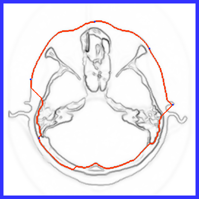 File:TestDijkstraImageGeodesicPath.png