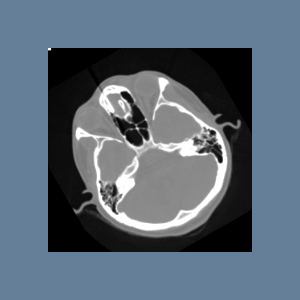 ITK Examples Baseline Iterators TestImageRegionIteratorWithIndex.png