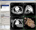 Thumbnail for version as of 23:05, 11 November 2005