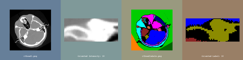 File:ITK Examples Baseline ImageProcessing TestLabelGeometryImageFilter 1.png