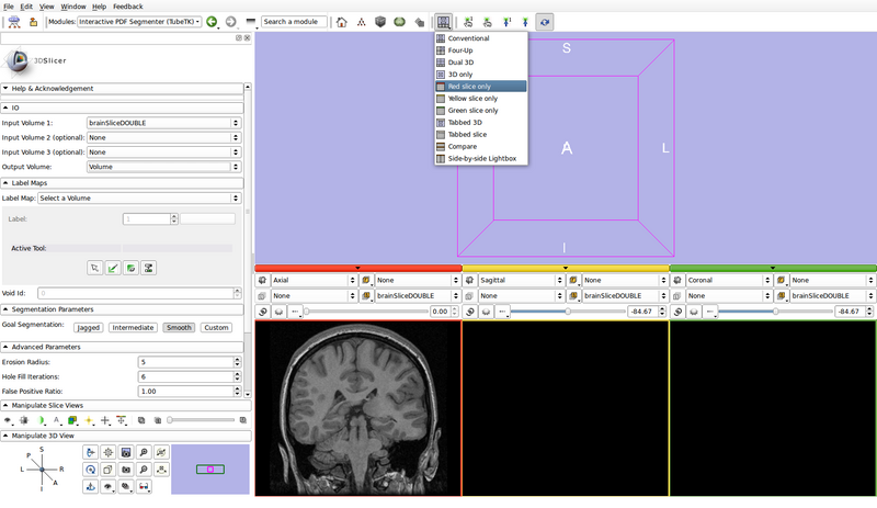 InteractivePDFSegmenterTutorial step4a.png